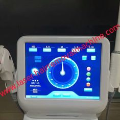 China Niet - Invasieve Hifu-Machine 3,0/4,5 Mm is voor Vagina Aanhalend AC 110V - 240V leverancier